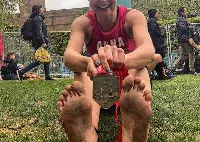 Gallery of foot injuries caused by running barefoot across Britain.