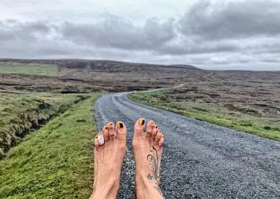 Gallery of foot injuries caused by running barefoot across Britain.