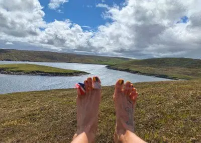 Gallery of foot injuries caused by running barefoot across Britain.